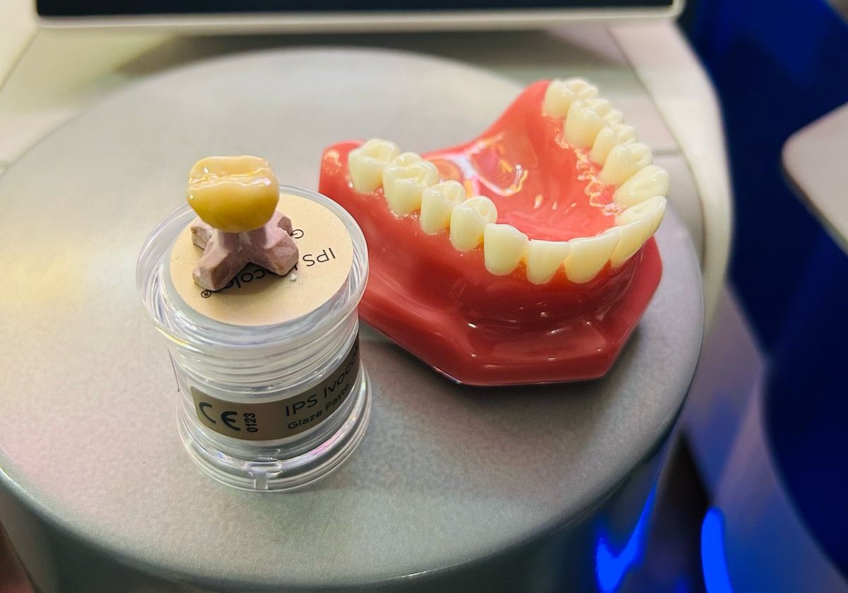 In house cerec Lab