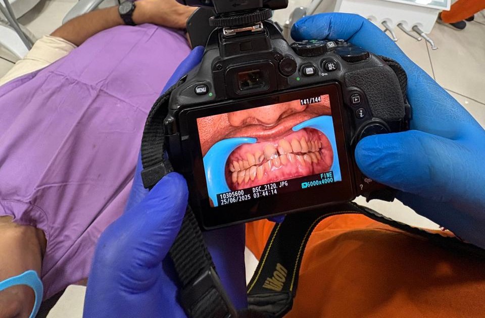 Smile Designing
